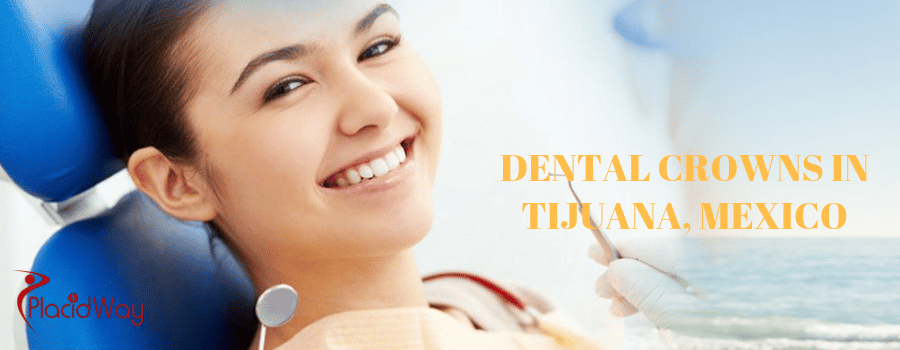 Best dentist in Tijuana for crowns